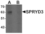 Western blot - SPRYD3 Antibody from Signalway Antibody (25329) - Antibodies.com