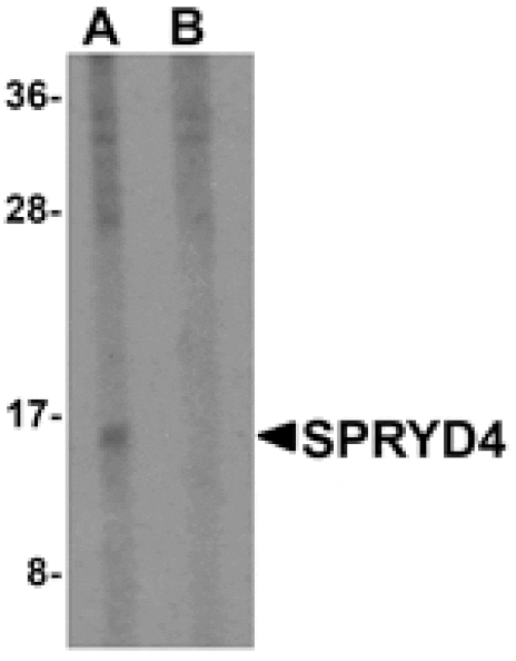 Western blot - SPRYD4 Antibody from Signalway Antibody (25330) - Antibodies.com