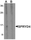 Western blot - SPRYD4 Antibody from Signalway Antibody (25330) - Antibodies.com