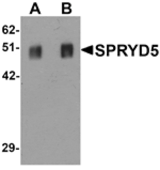 Western blot - SPRYD5 Antibody from Signalway Antibody (25331) - Antibodies.com