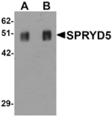 Western blot - SPRYD5 Antibody from Signalway Antibody (25331) - Antibodies.com