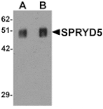 Western blot - SPRYD5 Antibody from Signalway Antibody (25331) - Antibodies.com