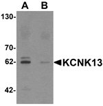Western blot analysis of KCNK13 in rat brain tissue lysate with KCNK13 antibody at 0.5 µg/mL in (A) the absence and (B) the presence of blocking peptide.