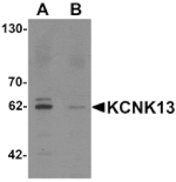 Western blot - KCNK13 Antibody from Signalway Antibody (25335) - Antibodies.com