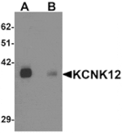 Western blot - KCNK12 Antibody from Signalway Antibody (25336) - Antibodies.com