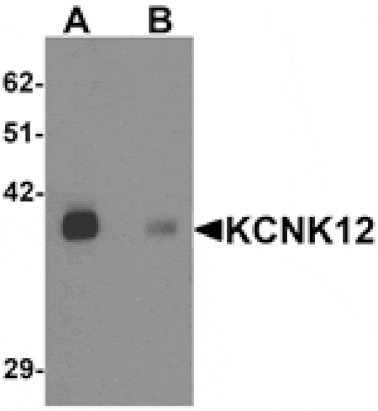 Western blot - KCNK12 Antibody from Signalway Antibody (25336) - Antibodies.com