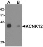 Western blot - KCNK12 Antibody from Signalway Antibody (25336) - Antibodies.com