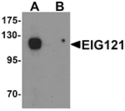 Western blot - EIG121 Antibody from Signalway Antibody (25341) - Antibodies.com