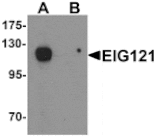 Western blot - EIG121 Antibody from Signalway Antibody (25341) - Antibodies.com