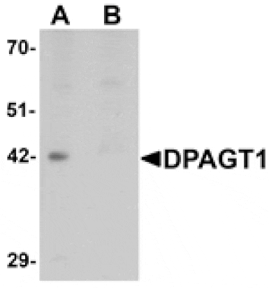 Western blot - DPAGT1 Antibody from Signalway Antibody (25355) - Antibodies.com