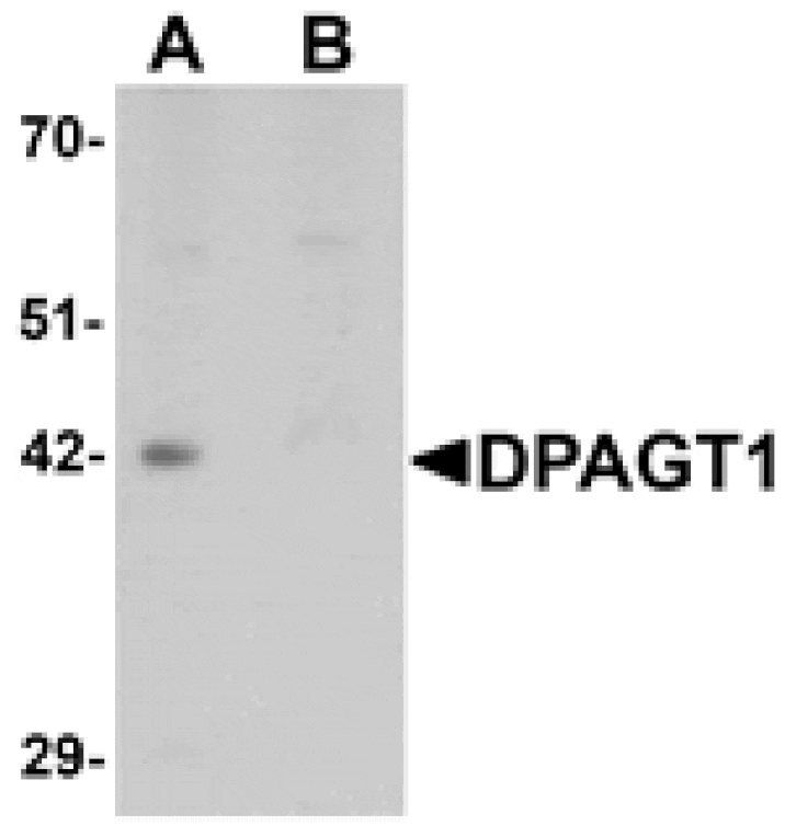 Western blot - DPAGT1 Antibody from Signalway Antibody (25355) - Antibodies.com