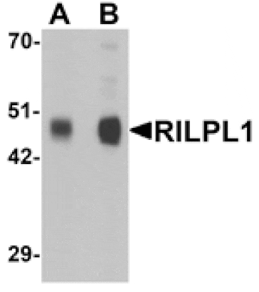Western blot - RILPL1 Antibody from Signalway Antibody (25360) - Antibodies.com