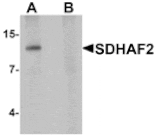 Western blot - SDHAF2 Antibody from Signalway Antibody (25363) - Antibodies.com