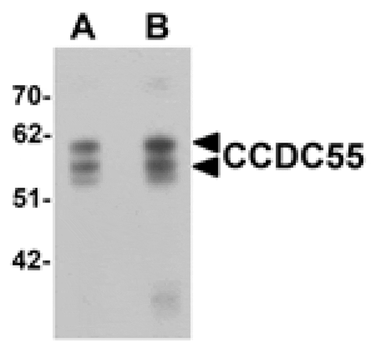Western blot - CCDC55 Antibody from Signalway Antibody (25366) - Antibodies.com