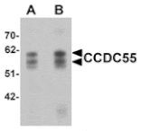 Western blot - CCDC55 Antibody from Signalway Antibody (25366) - Antibodies.com