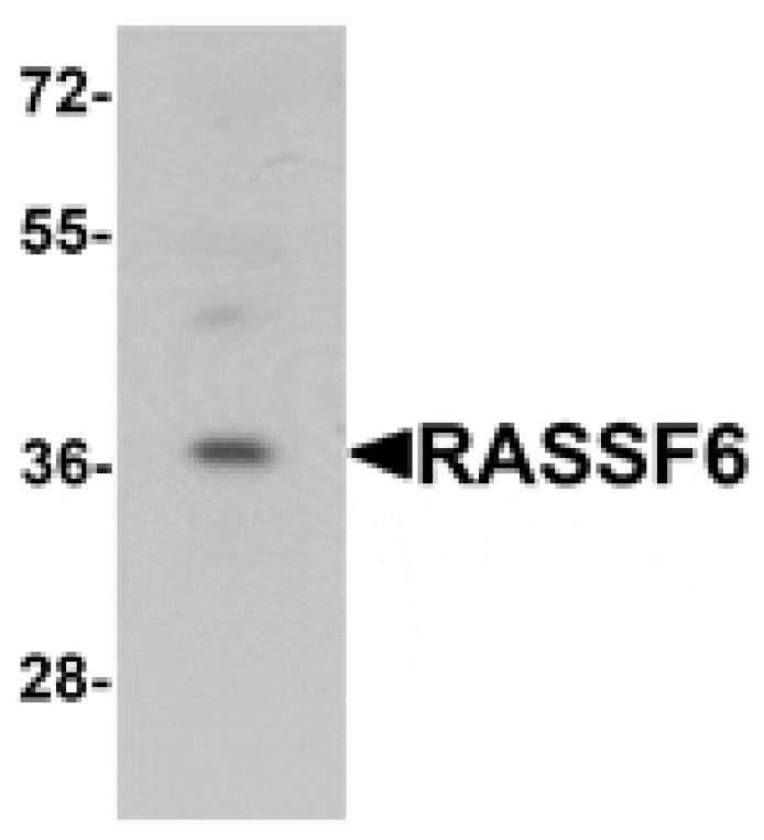 Western blot - RASSF6 Antibody from Signalway Antibody (25373) - Antibodies.com