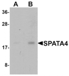 Western blot - SPATA4 Antibody from Signalway Antibody (25378) - Antibodies.com