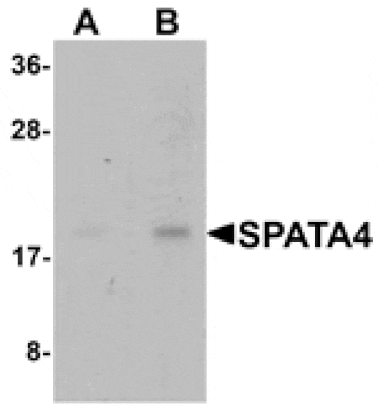 Western blot - SPATA4 Antibody from Signalway Antibody (25378) - Antibodies.com