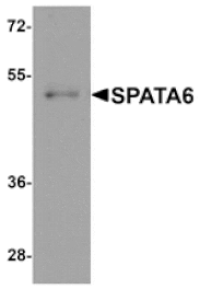 Western blot - SPATA6 Antibody from Signalway Antibody (25379) - Antibodies.com