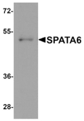 Western blot - SPATA6 Antibody from Signalway Antibody (25379) - Antibodies.com