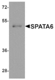 Western blot - SPATA6 Antibody from Signalway Antibody (25379) - Antibodies.com