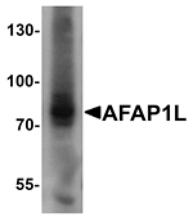 Western blot - AFAP1L Antibody from Signalway Antibody (25381) - Antibodies.com