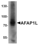 Western blot - AFAP1L Antibody from Signalway Antibody (25381) - Antibodies.com