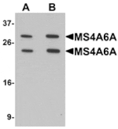 Western blot - MS4A6A Antibody from Signalway Antibody (25386) - Antibodies.com