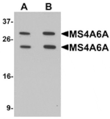 Western blot - MS4A6A Antibody from Signalway Antibody (25386) - Antibodies.com