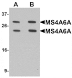 Western blot - MS4A6A Antibody from Signalway Antibody (25386) - Antibodies.com