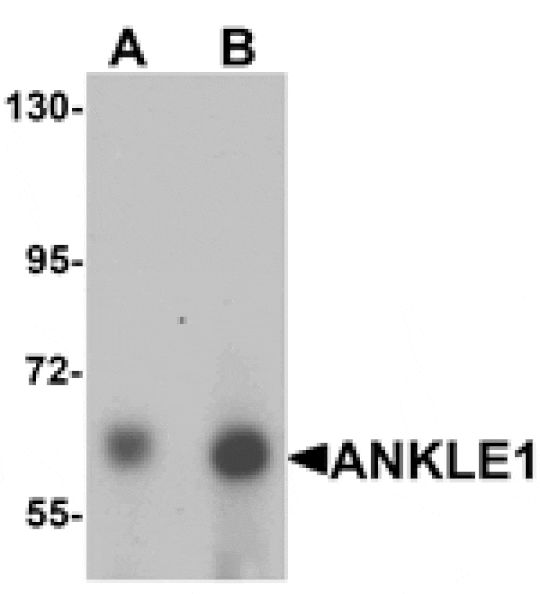 Western blot - ANKLE1 Antibody from Signalway Antibody (25391) - Antibodies.com