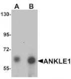 Western blot - ANKLE1 Antibody from Signalway Antibody (25391) - Antibodies.com