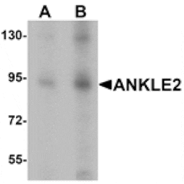 Western blot - ANKLE2 Antibody from Signalway Antibody (25392) - Antibodies.com