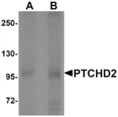 Western blot - PTCHD2 Antibody from Signalway Antibody (25404) - Antibodies.com