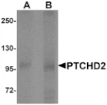 Western blot - PTCHD2 Antibody from Signalway Antibody (25404) - Antibodies.com