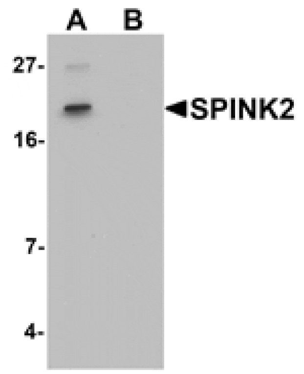 Western blot - SPINK2 Antibody from Signalway Antibody (25415) - Antibodies.com