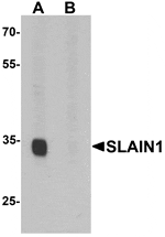 Western blot analysis of SLAIN1 in A549 cell lysate with SLAIN1 antibody at 1 µg/mL in (A) the absence and (B) the presence of blocking peptide.