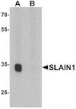 Western blot - SLAIN1 Antibody from Signalway Antibody (25416) - Antibodies.com