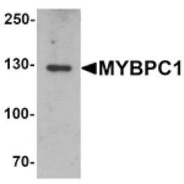Western blot - MYBPC1 Antibody from Signalway Antibody (25418) - Antibodies.com