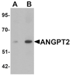 Western blot - ANGPT2 Antibody from Signalway Antibody (25428) - Antibodies.com