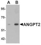 Western blot - ANGPT2 Antibody from Signalway Antibody (25428) - Antibodies.com