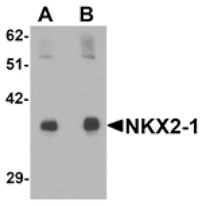 Western blot - NKX2-1 Antibody from Signalway Antibody (25429) - Antibodies.com