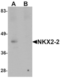 Western blot - NKX2-2 Antibody from Signalway Antibody (25430) - Antibodies.com