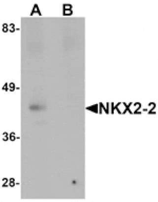 Western blot - NKX2-2 Antibody from Signalway Antibody (25430) - Antibodies.com