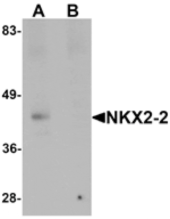 Western blot - NKX2-2 Antibody from Signalway Antibody (25430) - Antibodies.com