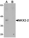 Western blot - NKX2-2 Antibody from Signalway Antibody (25430) - Antibodies.com