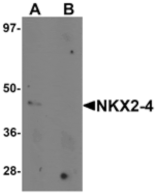 Western blot - NKX2-4 Antibody from Signalway Antibody (25431) - Antibodies.com