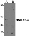 Western blot - NKX2-4 Antibody from Signalway Antibody (25431) - Antibodies.com