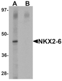 Western blot - NKX2-6 Antibody from Signalway Antibody (25432) - Antibodies.com