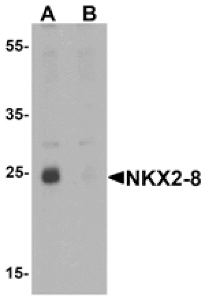 Western blot - NKX2-8 Antibody from Signalway Antibody (25433) - Antibodies.com